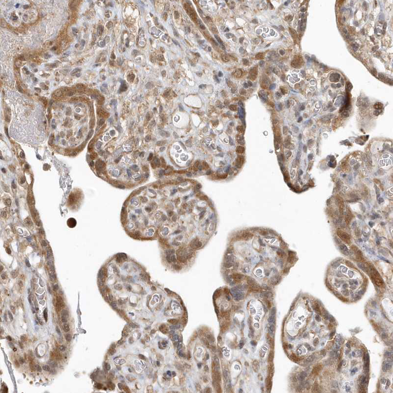Immunohistochemistry (Formalin/PFA-fixed paraffin-embedded sections) - Anti-PSMD6 antibody (AB247004)