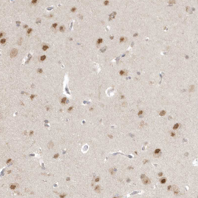 Immunohistochemistry (Formalin/PFA-fixed paraffin-embedded sections) - Anti-PSMD6 antibody (AB247004)