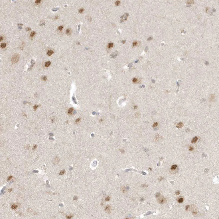 Immunohistochemistry (Formalin/PFA-fixed paraffin-embedded sections) - Anti-PSMD6 antibody (AB247004)