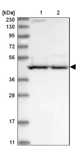 Western blot - Anti-PSMD6 antibody (AB247004)