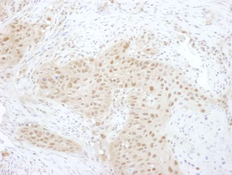 Immunohistochemistry (Formalin/PFA-fixed paraffin-embedded sections) - Anti-PSMD7/Mov34 antibody (AB140428)