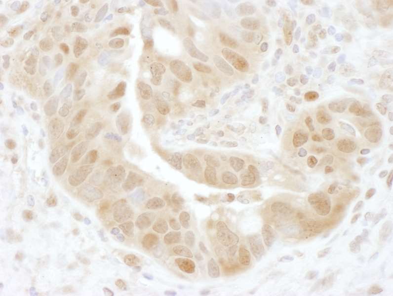 Immunohistochemistry (Formalin/PFA-fixed paraffin-embedded sections) - Anti-PSMD7/Mov34 antibody (AB140428)