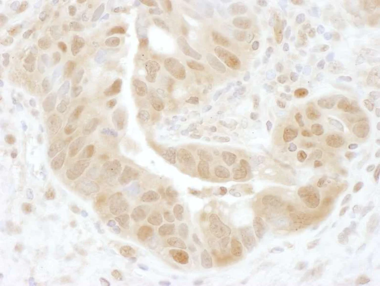 Immunohistochemistry (Formalin/PFA-fixed paraffin-embedded sections) - Anti-PSMD7/Mov34 antibody (AB140428)