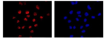 Immunocytochemistry/ Immunofluorescence - Anti-PSMD7/Mov34 antibody [EPR13517] (AB181072)
