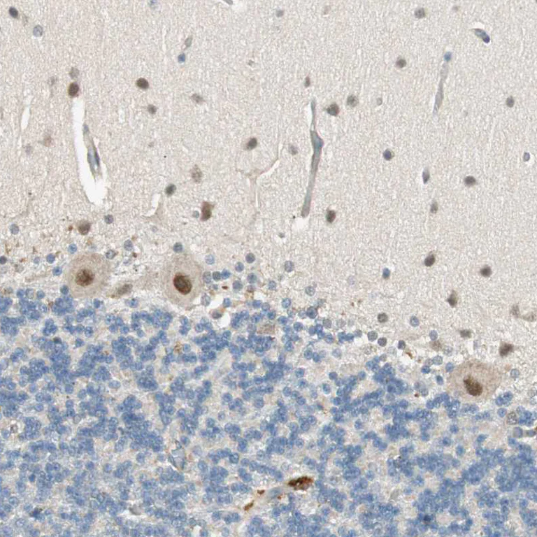 Immunohistochemistry (Formalin/PFA-fixed paraffin-embedded sections) - Anti-PSMD8 antibody (AB246883)