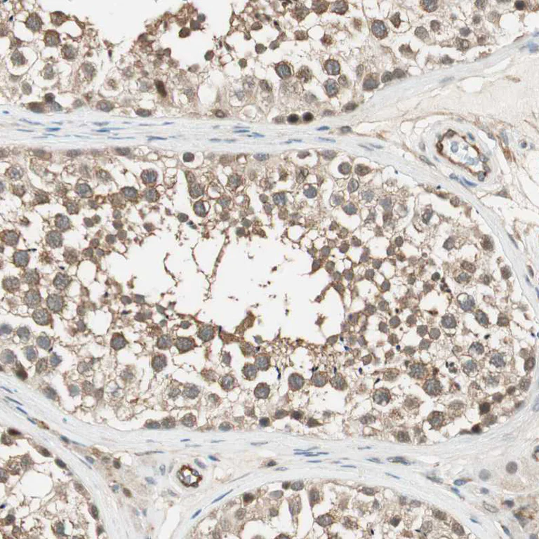 Immunohistochemistry (Formalin/PFA-fixed paraffin-embedded sections) - Anti-PSMD8 antibody (AB246883)