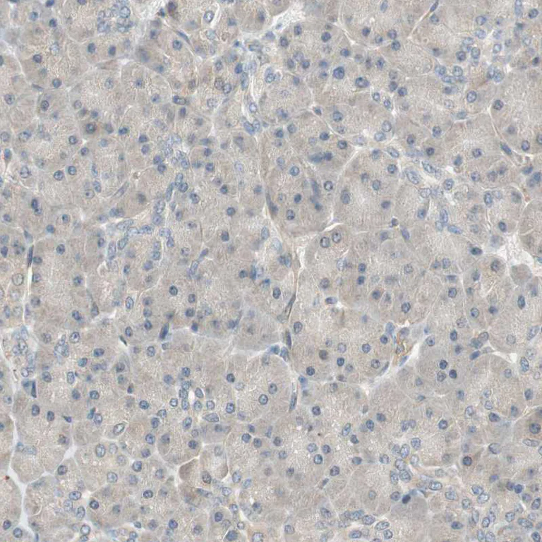 Immunohistochemistry (Formalin/PFA-fixed paraffin-embedded sections) - Anti-PSMD8 antibody (AB246883)