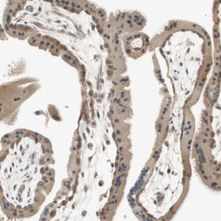 Immunohistochemistry (Formalin/PFA-fixed paraffin-embedded sections) - Anti-PSMD8 antibody (AB246883)