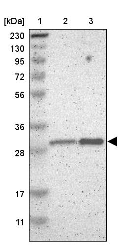 Western blot - Anti-PSMD8 antibody (AB246883)
