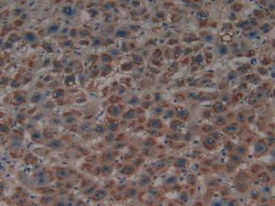Immunohistochemistry (Formalin/PFA-fixed paraffin-embedded sections) - Anti-PSMD9 antibody (ab233154), expandable thumbnail
