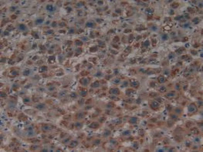 Immunohistochemistry (Formalin/PFA-fixed paraffin-embedded sections) - Anti-PSMD9 antibody (AB233154)