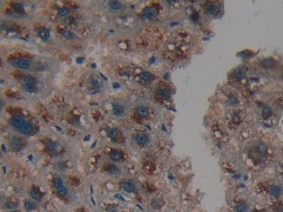 Immunohistochemistry (Formalin/PFA-fixed paraffin-embedded sections) - Anti-PSMD9 antibody (ab233154), expandable thumbnail