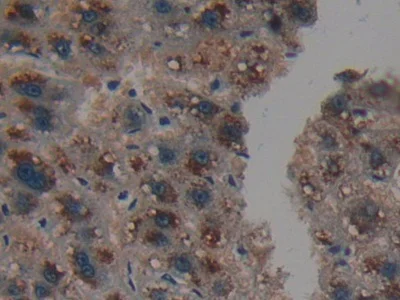 Immunohistochemistry (Formalin/PFA-fixed paraffin-embedded sections) - Anti-PSMD9 antibody (AB233154)