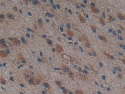 Immunohistochemistry (Formalin/PFA-fixed paraffin-embedded sections) - Anti-PSMD9 antibody (ab233154), expandable thumbnail