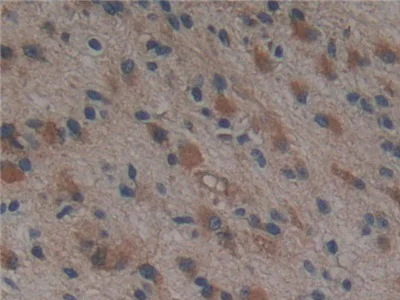 Immunohistochemistry (Formalin/PFA-fixed paraffin-embedded sections) - Anti-PSMD9 antibody (AB233154)