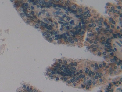 Immunohistochemistry (Formalin/PFA-fixed paraffin-embedded sections) - Anti-PSMD9 antibody (AB233154), expandable thumbnail