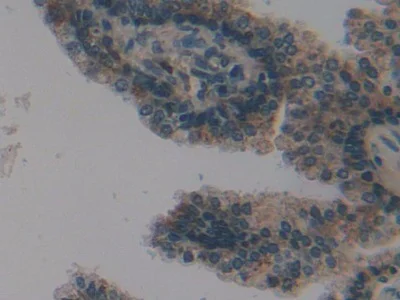 Immunohistochemistry (Formalin/PFA-fixed paraffin-embedded sections) - Anti-PSMD9 antibody (AB233154)