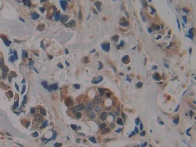 Immunohistochemistry (Formalin/PFA-fixed paraffin-embedded sections) - Anti-PSMD9 antibody (AB233154)