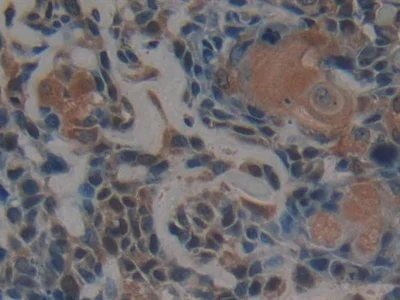 Immunohistochemistry (Formalin/PFA-fixed paraffin-embedded sections) - Anti-PSMD9 antibody (AB233154)