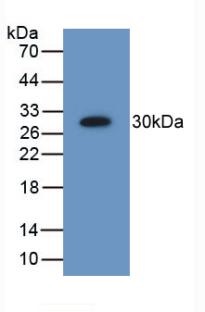 Western blot - Anti-PSMD9 antibody (ab233154), expandable thumbnail