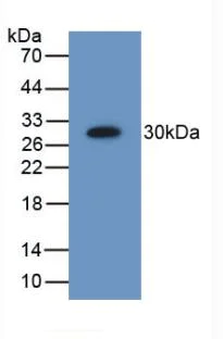 Western blot - Anti-PSMD9 antibody (AB233154)
