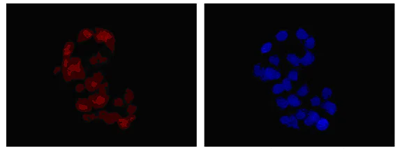 Immunocytochemistry/ Immunofluorescence - Anti-PSMD9 antibody [EPR12947] - BSA and Azide free (AB250563)