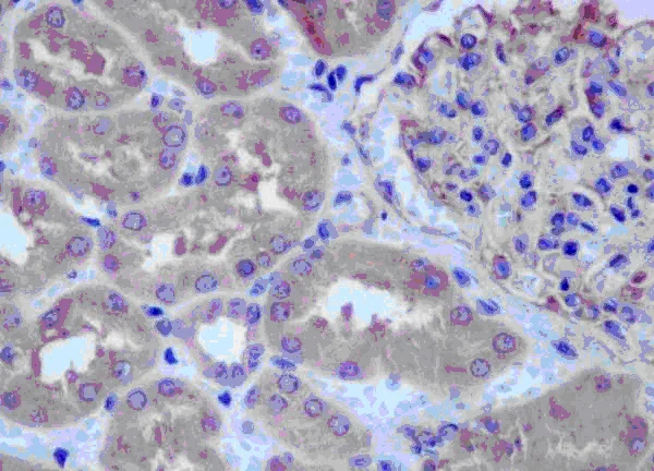 Immunohistochemistry (Formalin/PFA-fixed paraffin-embedded sections) - Anti-PSMD9 antibody [EPR12947] - BSA and Azide free (AB250563)