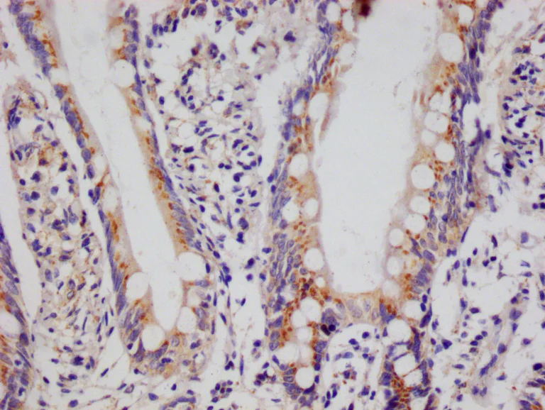 Immunohistochemistry (Formalin/PFA-fixed paraffin-embedded sections) - Anti-PSME1 antibody [29D5] (AB314183)