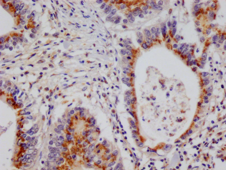 Immunohistochemistry (Formalin/PFA-fixed paraffin-embedded sections) - Anti-PSME1 antibody [29D5] (AB314183)
