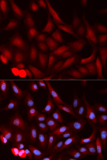 Immunocytochemistry/ Immunofluorescence - Anti-PSME1 antibody (AB186832)