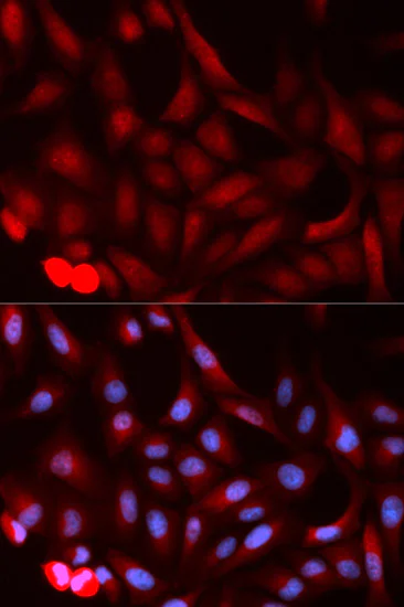 Immunocytochemistry/ Immunofluorescence - Anti-PSME1 antibody (AB186832)