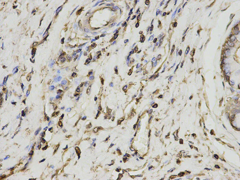 Immunohistochemistry (Formalin/PFA-fixed paraffin-embedded sections) - Anti-PSME1 antibody (AB186832)