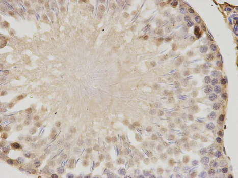 Immunohistochemistry (Formalin/PFA-fixed paraffin-embedded sections) - Anti-PSME1 antibody (AB186832)