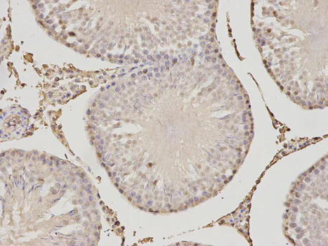 Immunohistochemistry (Formalin/PFA-fixed paraffin-embedded sections) - Anti-PSME1 antibody (AB186832)