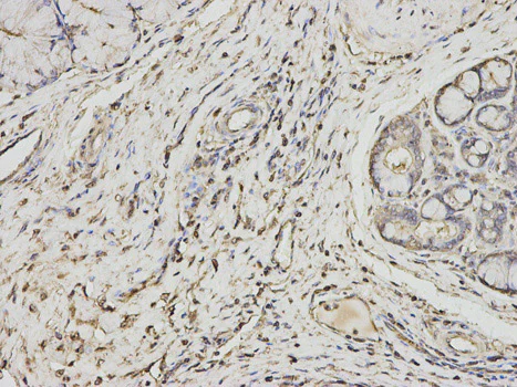 Immunohistochemistry (Formalin/PFA-fixed paraffin-embedded sections) - Anti-PSME1 antibody (AB186832)