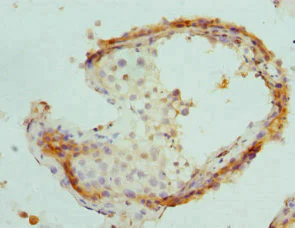 Immunohistochemistry (Formalin/PFA-fixed paraffin-embedded sections) - Anti-PSME1 antibody (AB236877)