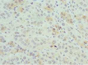 Immunohistochemistry (Formalin/PFA-fixed paraffin-embedded sections) - Anti-PSME1 antibody (AB236877)