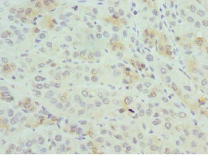 Immunohistochemistry (Formalin/PFA-fixed paraffin-embedded sections) - Anti-PSME1 antibody (AB236877)