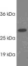 Western blot - Anti-PSME1 antibody (AB3333)