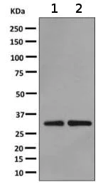 Western blot - Anti-PSME1 antibody [EPR10967(B)] (AB155091)
