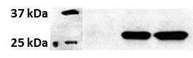 Western blot - Anti-PSME1 antibody [EPR10967(B)] (AB155091)