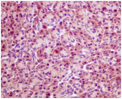 Immunohistochemistry (Formalin/PFA-fixed paraffin-embedded sections) - Anti-PSME1 antibody [EPR10968(B)] (AB155985), expandable thumbnail