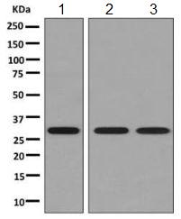 Western blot - Anti-PSME1 antibody [EPR10968(B)] (AB155985), expandable thumbnail