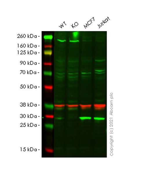 Western blot - Anti-PSME1 antibody [EPR10968(B)] (AB155985), expandable thumbnail