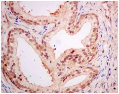 Immunohistochemistry (Formalin/PFA-fixed paraffin-embedded sections) - Anti-PSME1 antibody [EPR10968(B)] - BSA and Azide free (AB249230)