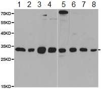 Western blot - Anti-PSME2 antibody (AB187528), expandable thumbnail