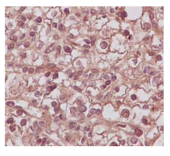 Anti-PSME2 antibody [EPR14931]