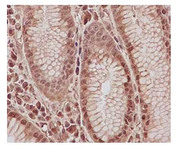 Immunohistochemistry (Formalin/PFA-fixed paraffin-embedded sections) - Anti-PSME2 antibody [EPR14931] - BSA and Azide free (AB250700)