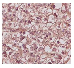 Immunohistochemistry (Formalin/PFA-fixed paraffin-embedded sections) - Anti-PSME2 antibody [EPR14931] - BSA and Azide free (AB250700)