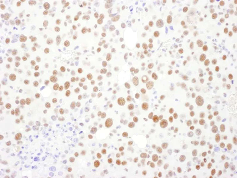 Immunohistochemistry (Formalin/PFA-fixed paraffin-embedded sections) - Anti-PSME3 antibody (AB157157)
